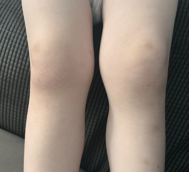 Knee problems