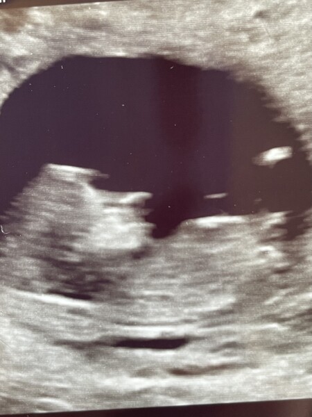 Does this picture work with nub theory? Guesses if so:-)