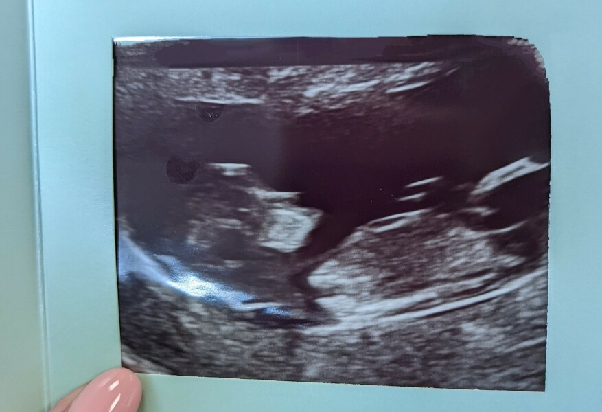 Any guesses at gender?
