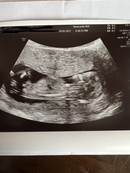 Gender guesses/nub theory? 