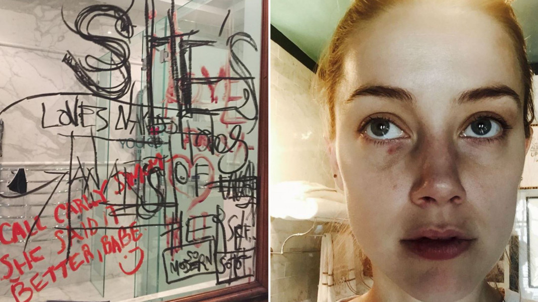 Anyone watching Amber heard take the stand?