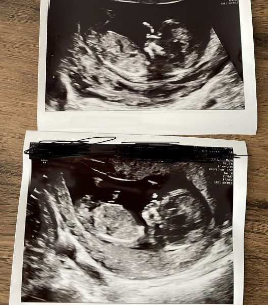 Scan pic - boy or girl? Just for fun!