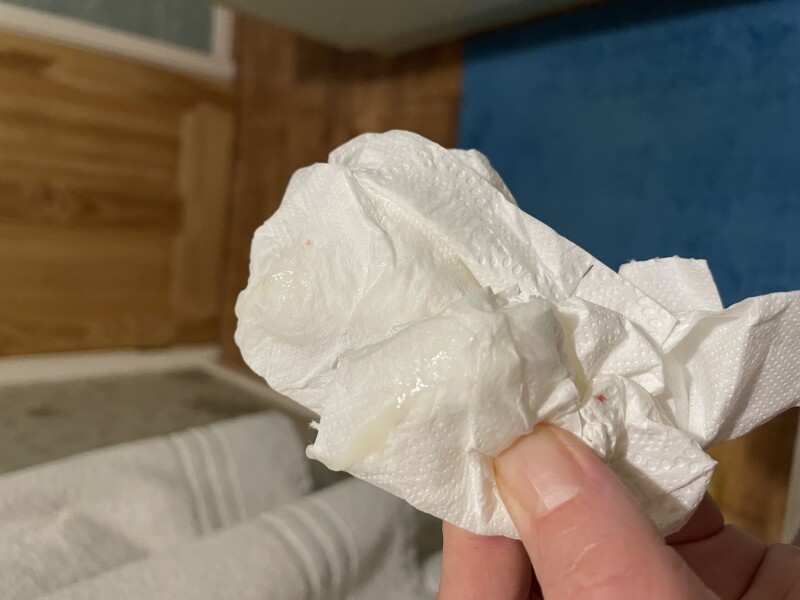 Is this part of mucous plug (pic attached)