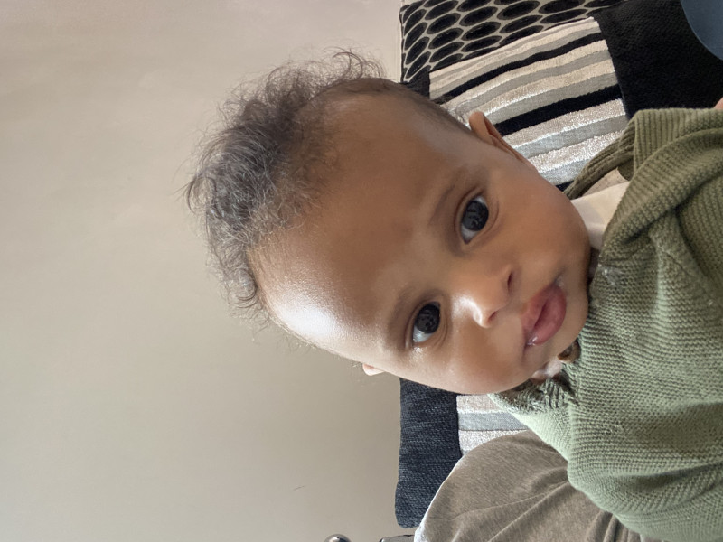 White patches on face