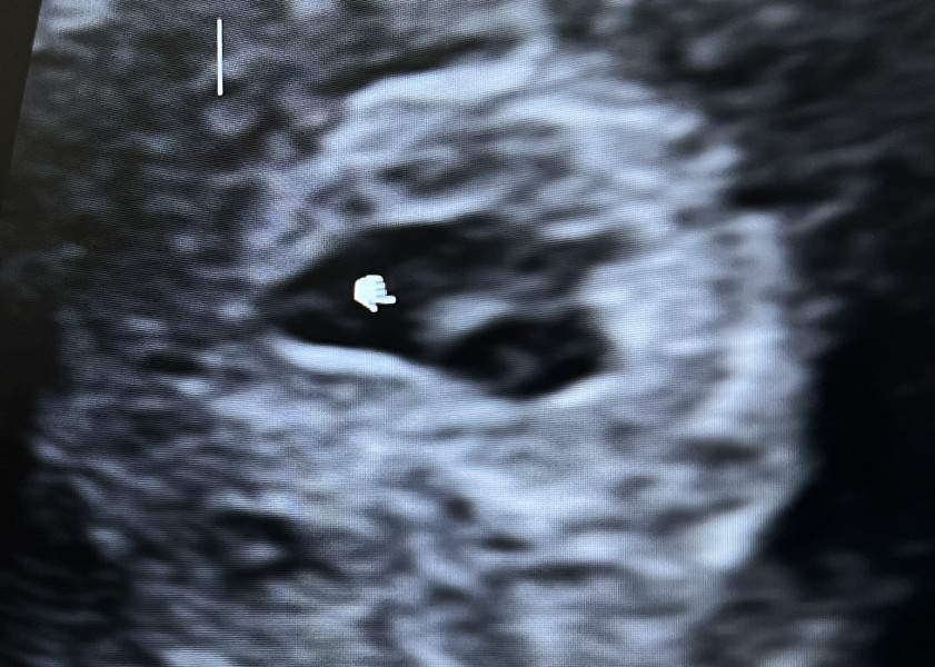early scan help please 