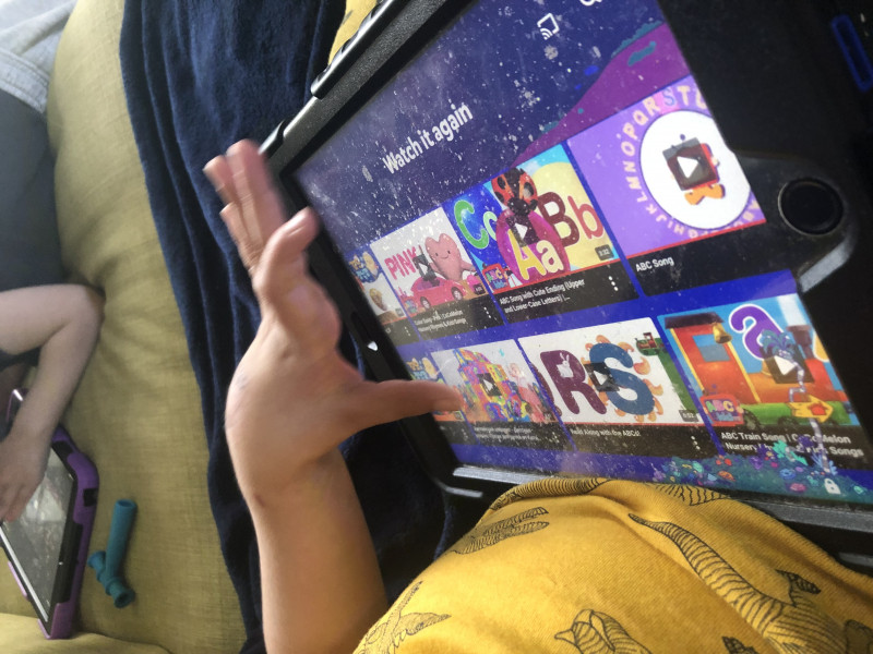 Kids recovering from broken bones - any experiences?