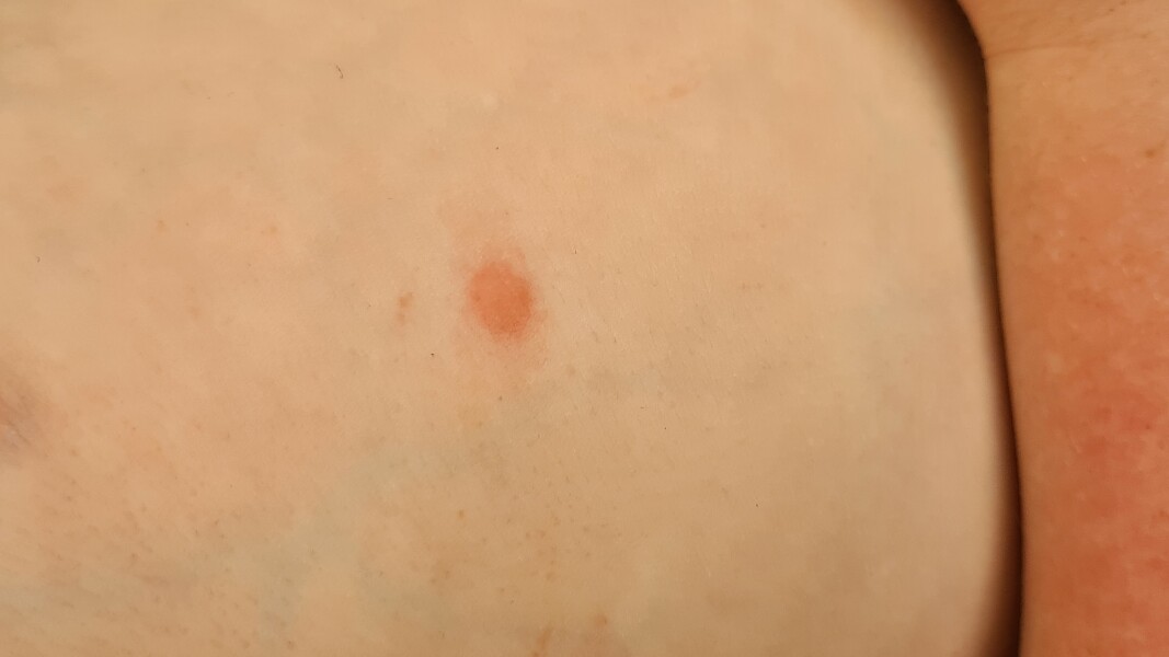 Whats theses spots  (pic)