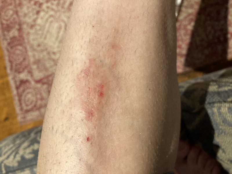 What is this itchy skin?