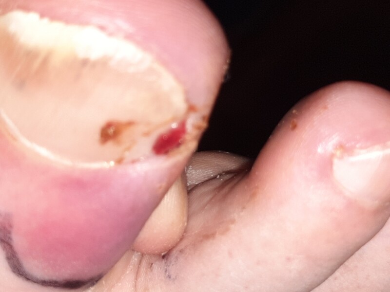 Does this need medical attention? Pics