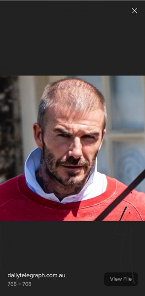 Has David Beckham had work done?