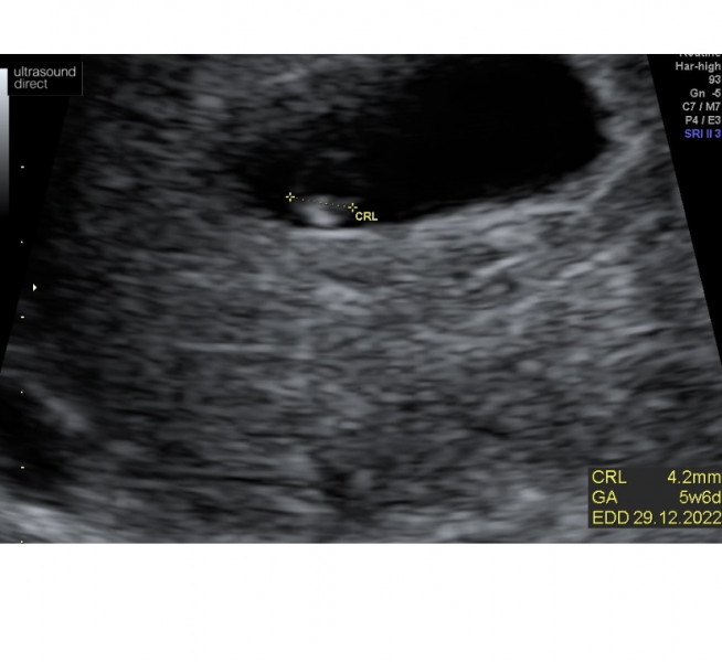 Due December '22 thread 2!