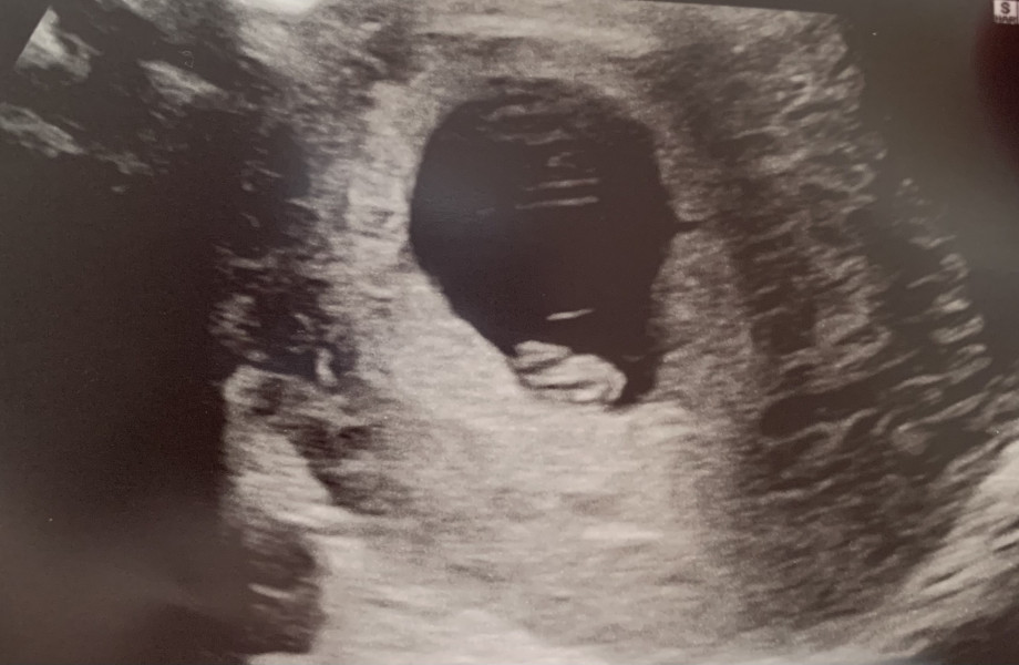 Due December '22 thread 2!