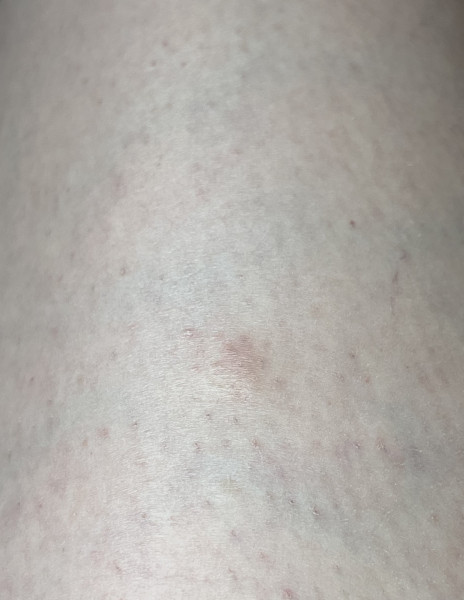 How urgently should I get this skin thing looked at? Got a bit flustered over it. 