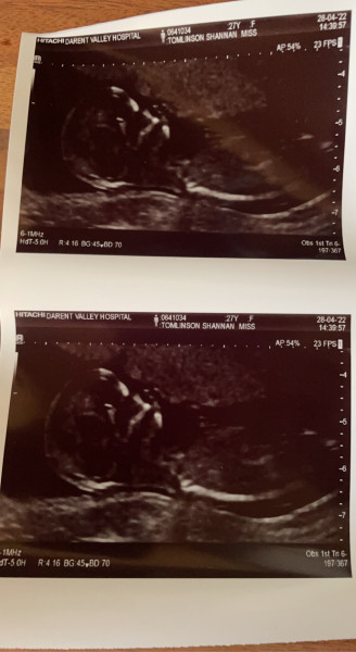 Gender guesses please ❤️
