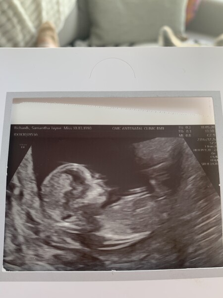 Guess baby’s gender from gender scan pic! 😍
