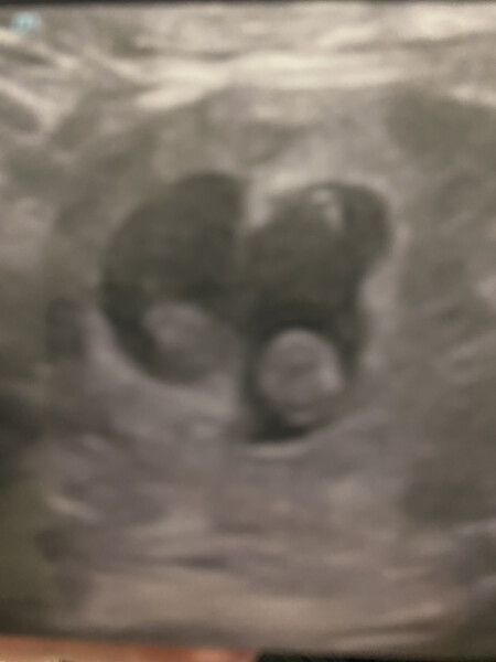 Preparing to TTC in 2022