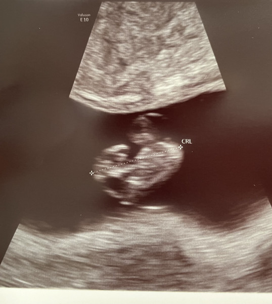 Due December '22 thread 2!