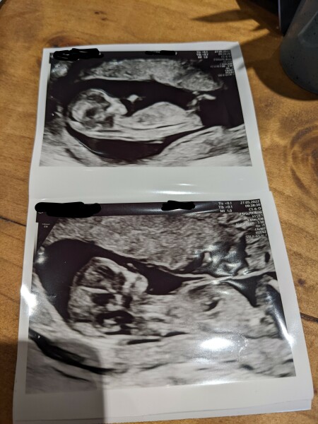Due December '22 thread 2!