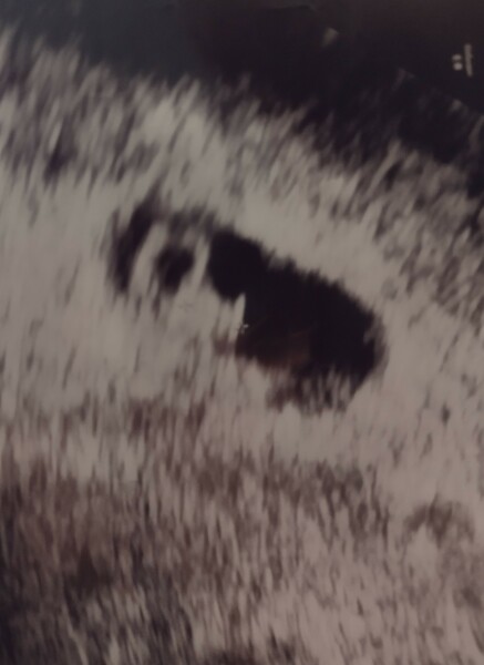 5wk 6days