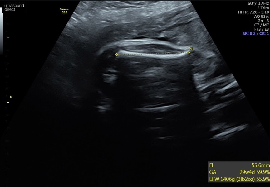 Gender guesses 💗💙💗💙