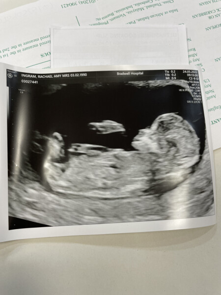 Navigating pregnancy after loss thread 3