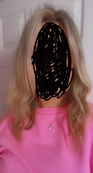 Is my hair too damaged to fix? (Pic included )