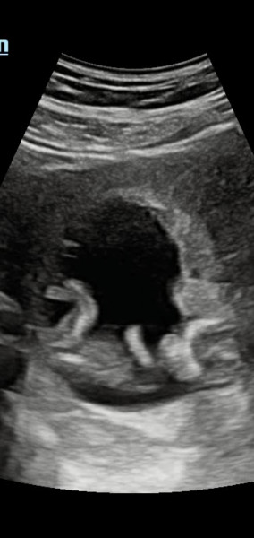 Any nub experts that can look at my scan? 