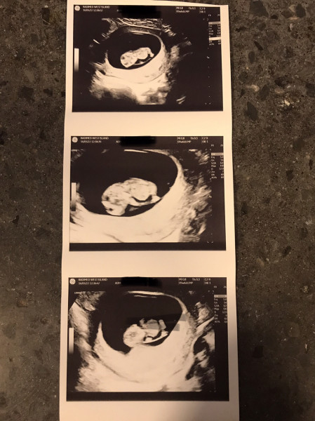 Due December '22 thread 2!