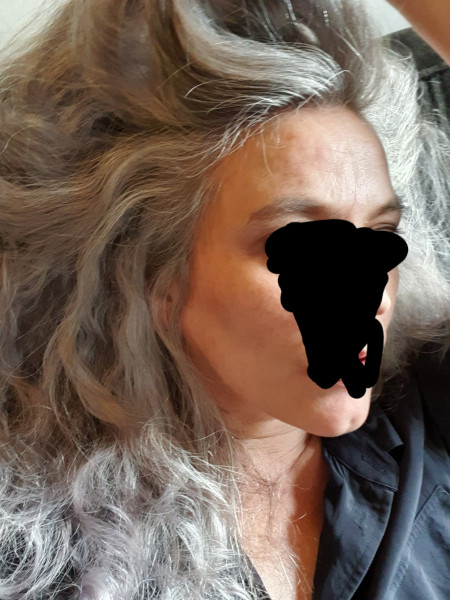 Tried to embrace the grey and am struggling, but allergic to hair dyes.. help please! 