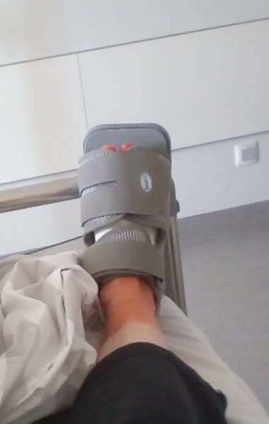 Bunion surgery tips please!