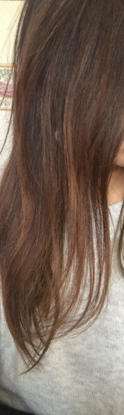Is my hair too damaged to fix? (Pic included )