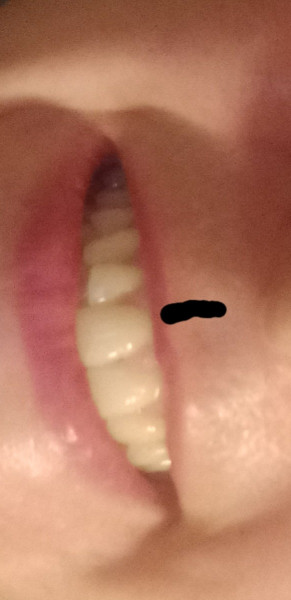 Is anyone knowledgeable about dentistry? I'm confused.
