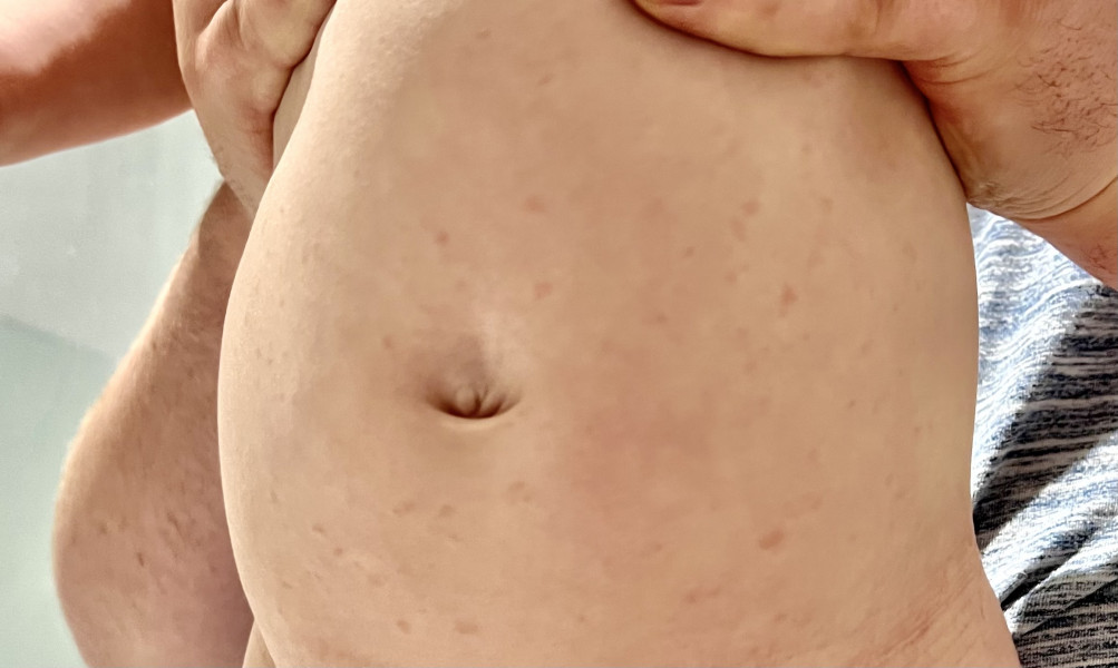 is this rash concerning? 