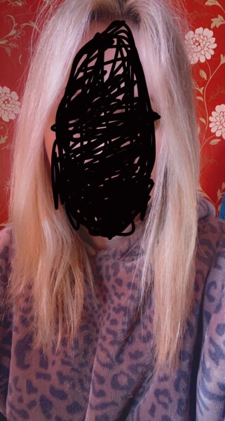 Is my hair too damaged to fix? (Pic included )