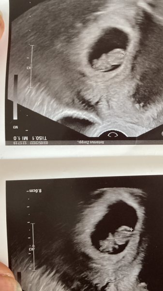 Due December '22 thread 2!