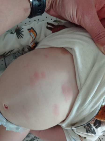 8mo Strange Rash, please advise picture attached
