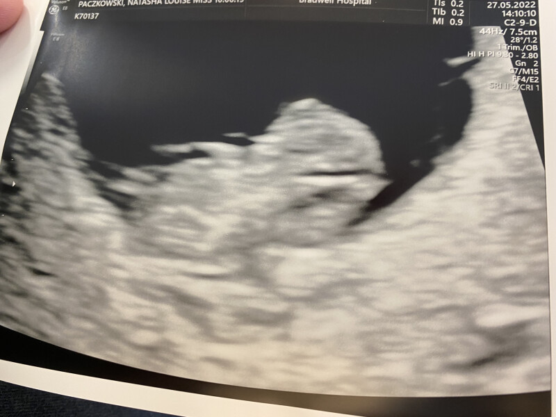 Due December '22 thread 2!