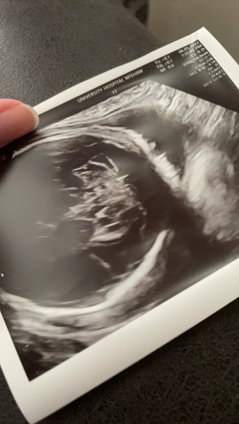 Due July 2022 (thread 4)