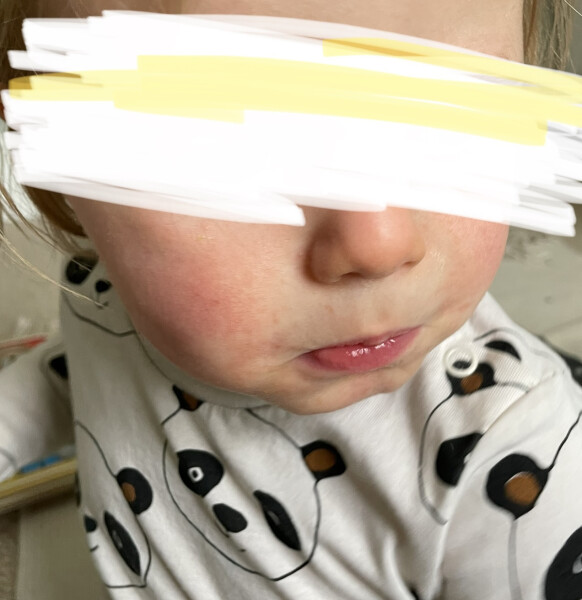 Constant rash on toddler's cheeks