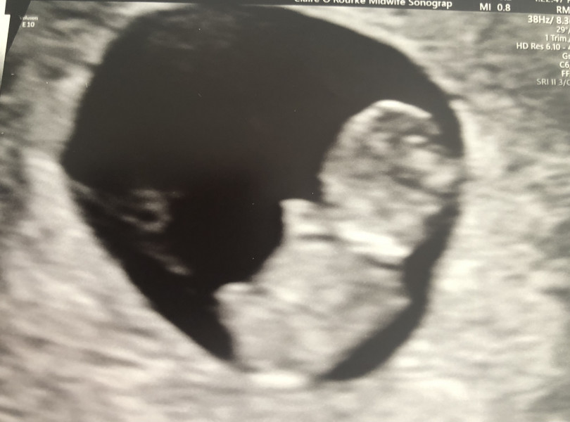 Due December '22 thread 2!