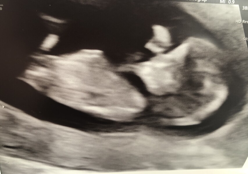 Due December '22 thread 2!