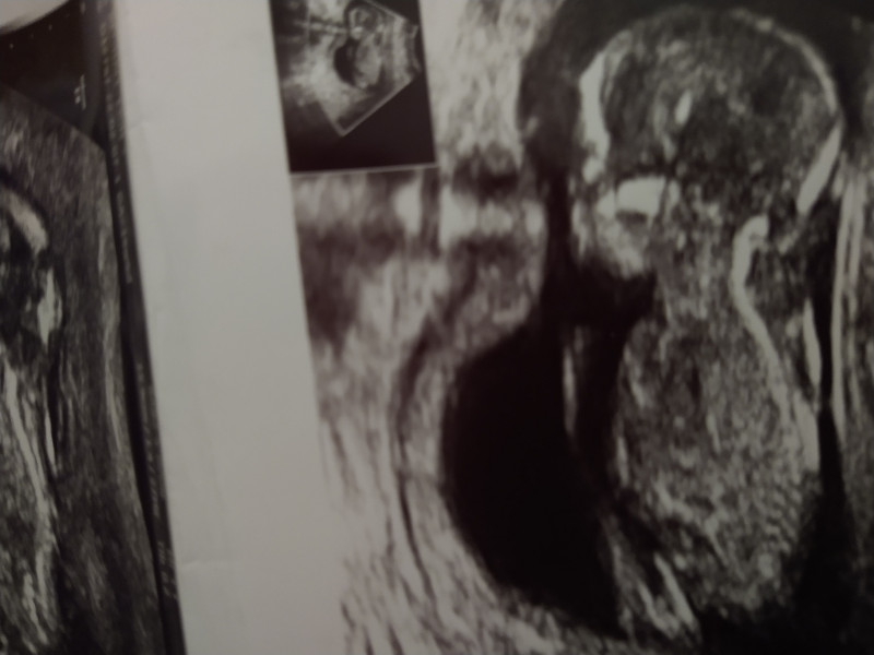 Gender guesses 💗💙💗💙