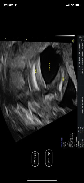 Guess baby’s gender from gender scan pic! 😍