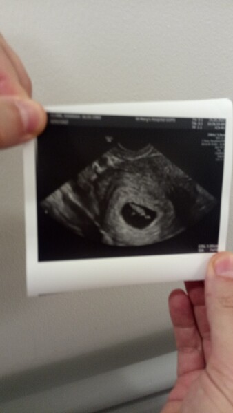 Due January 2023 ❤️