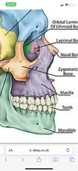 Dentists- What is this bump above my top teeth?