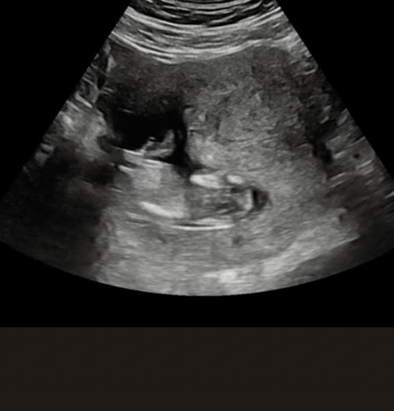 Nub guesses please 🥰