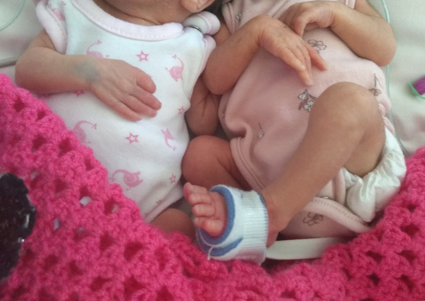 Twin pregnancy