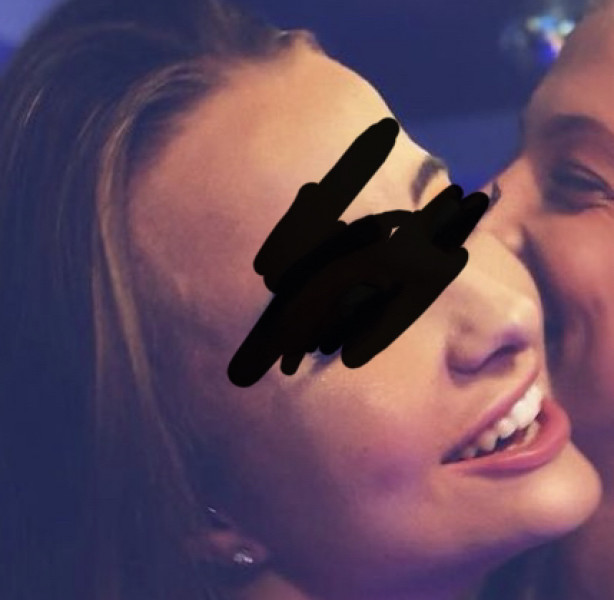 Lip filler on Monday and I’m so scared 