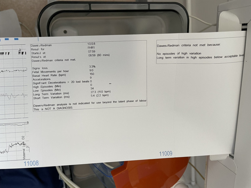 CTG failings