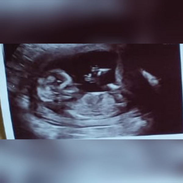 👶 Due November 2022 - part II 🎆